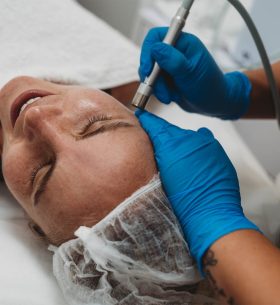 microdermabrasion